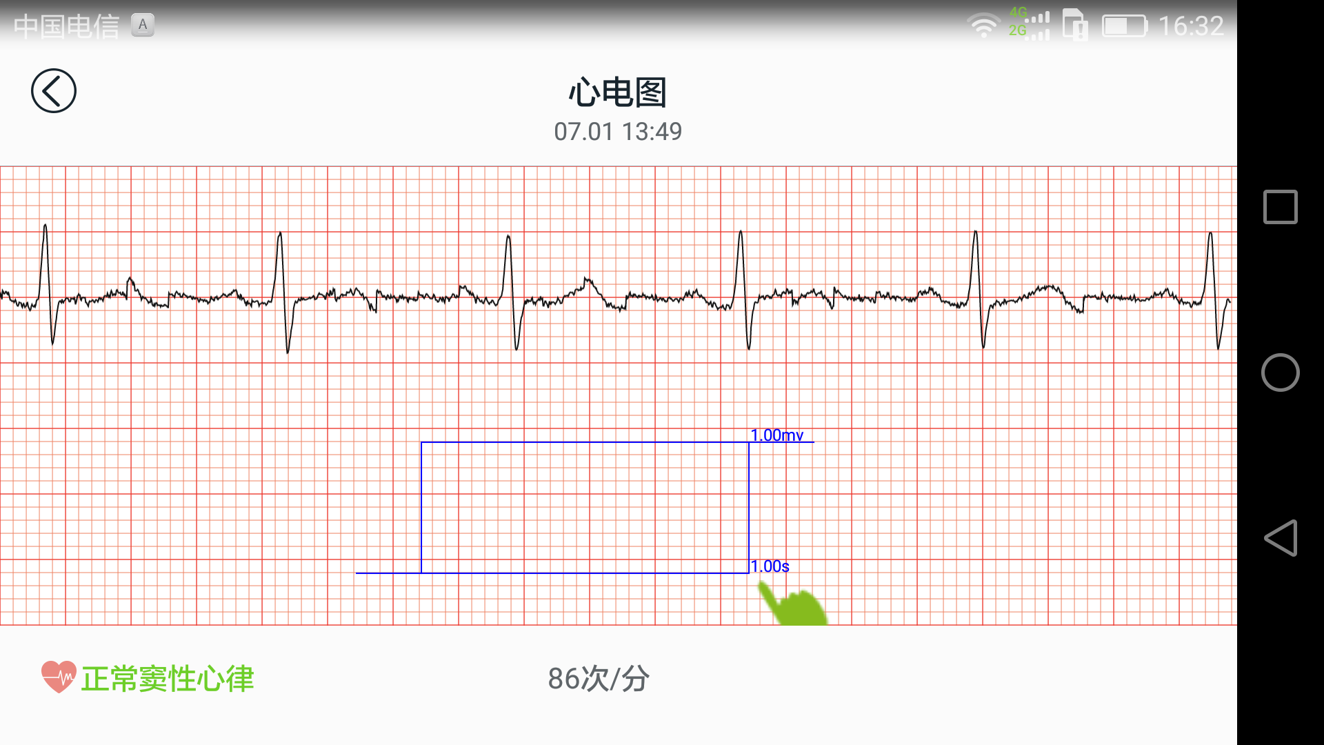 QQ图片20170701163534.png